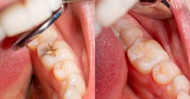 Preventing Tooth Infections